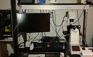 Diskovery Spinning Disk Image of a white inverted Leica DMi8 microscope connected to a black Quorum Diskovery Spinning Disk system