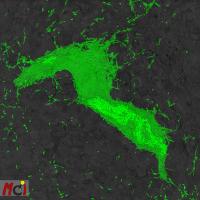 3D reconstruction of Pseudomonas aeruginosa biofilm on epithelial cells