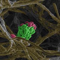 Colourized SEM image of mold in cheese