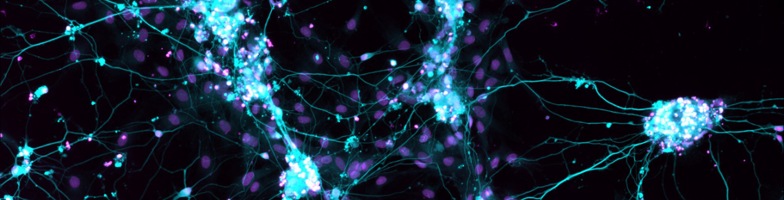 Neuroscience Research Logo. Microscopic image of glowing neural networks with a dark background.