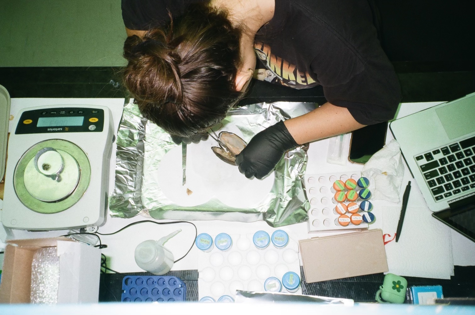 A woman working on a muscle's tissue on a table