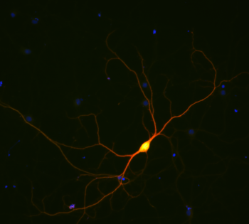 Enzymes in neurons, which look like lightening in a dark sky